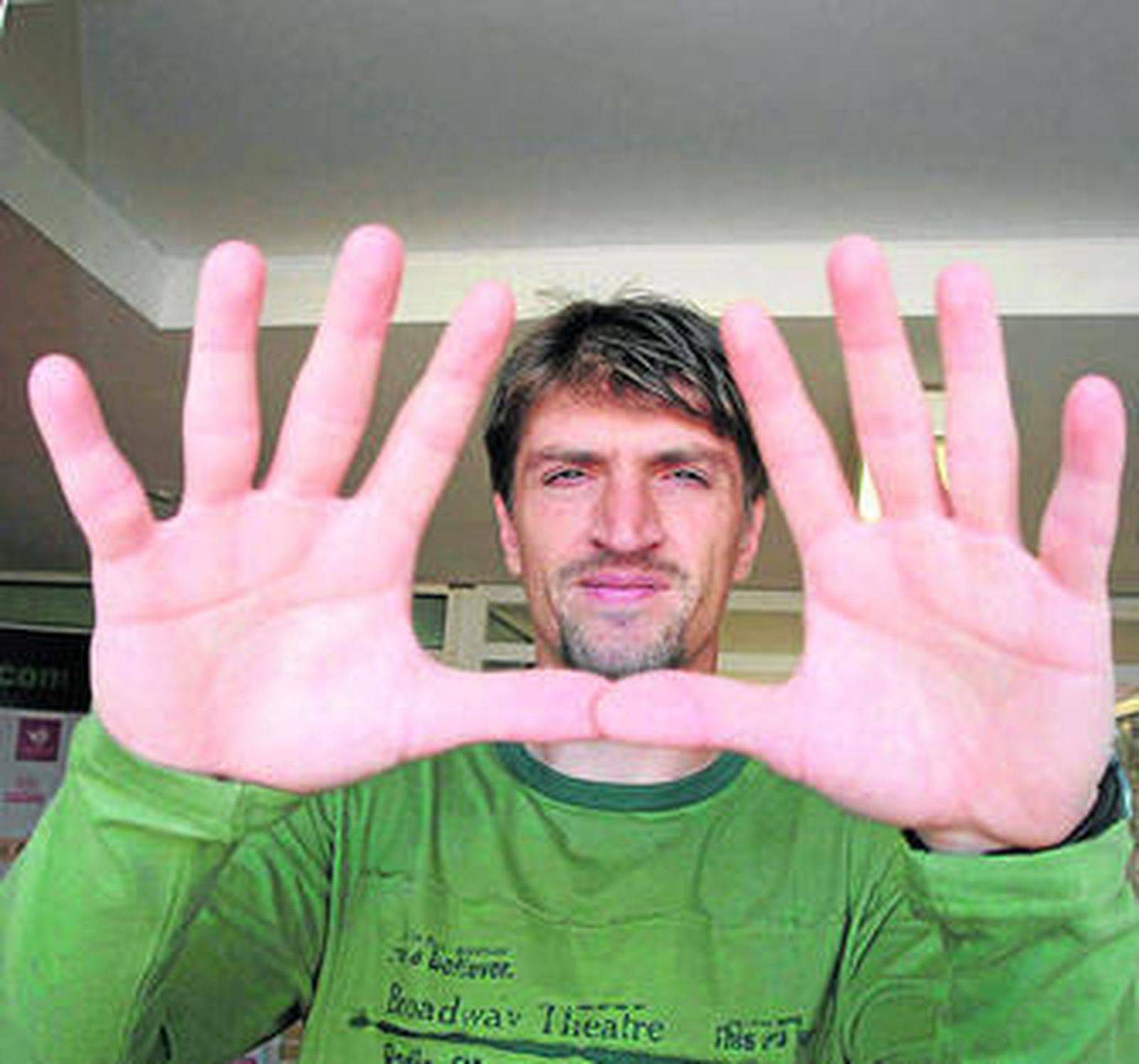 David Valle muestras sus manos en un posado para una entrevista.