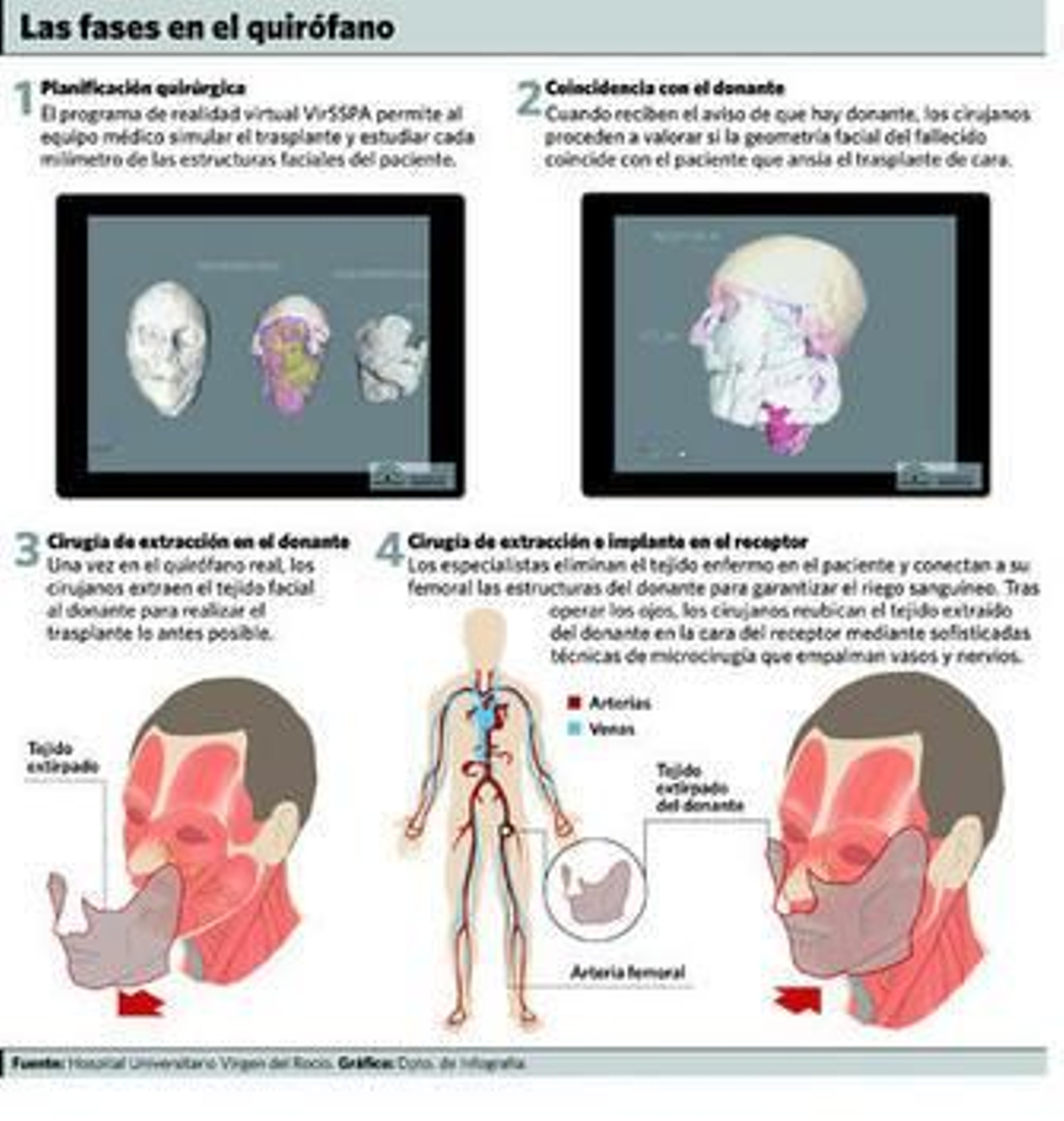 Especialistas durante la operación.