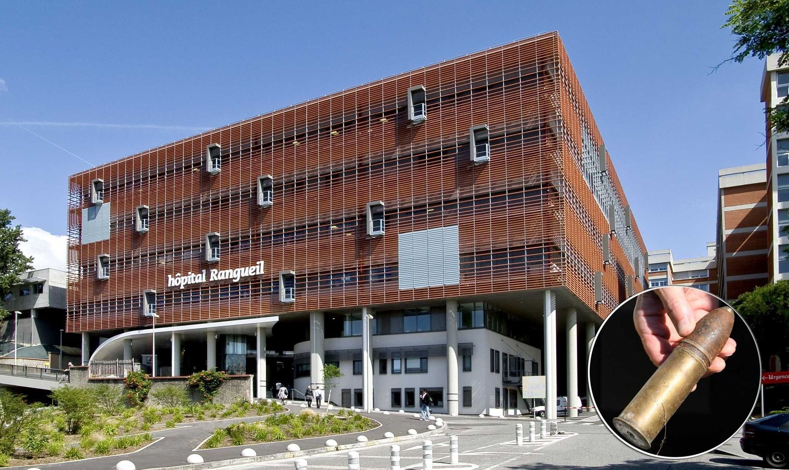 Imagen del hospital Rangueil con una imagen en pequeño del tipo de proyectil que encontraron