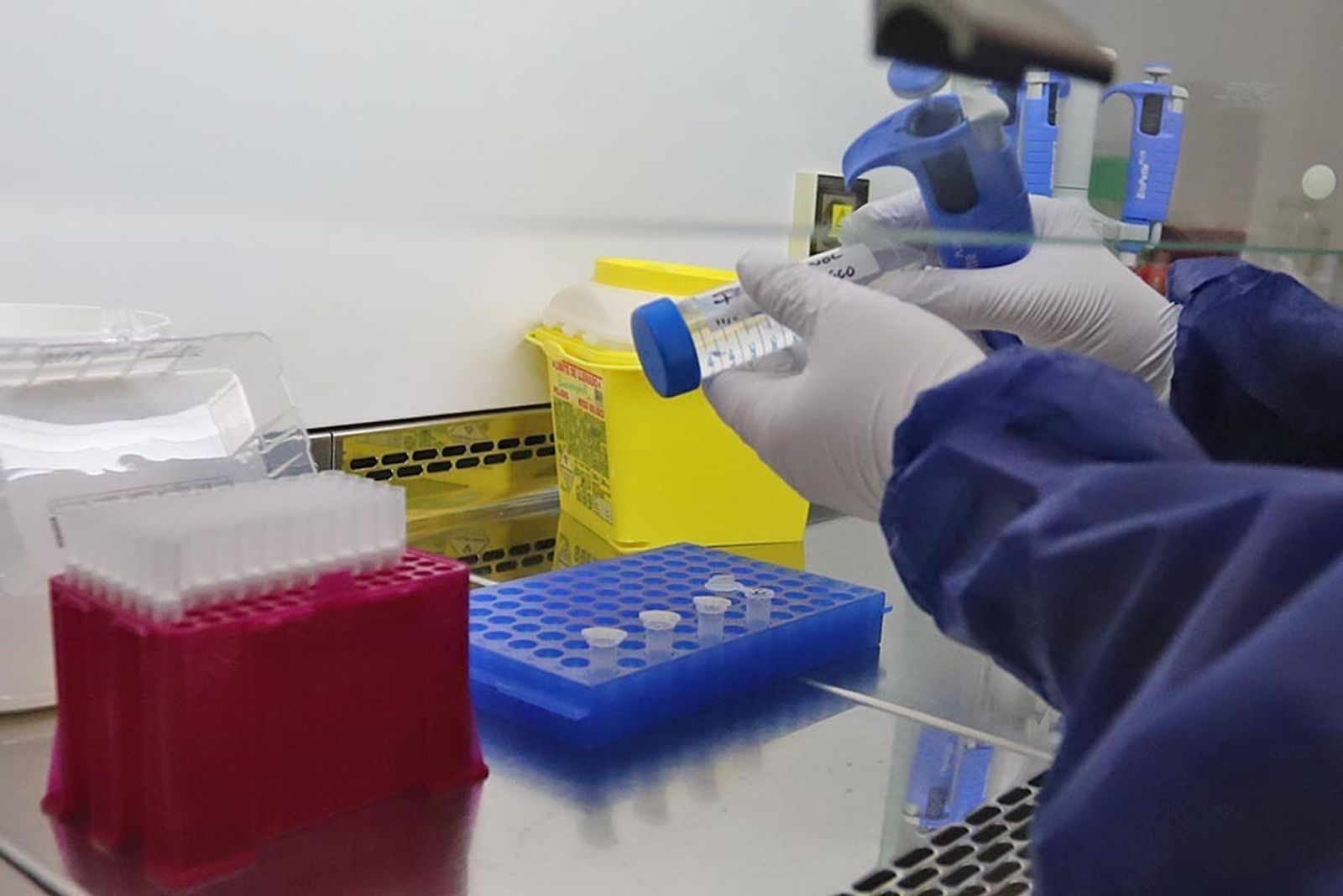 Un sanitario realiza un test de viruela del mono.