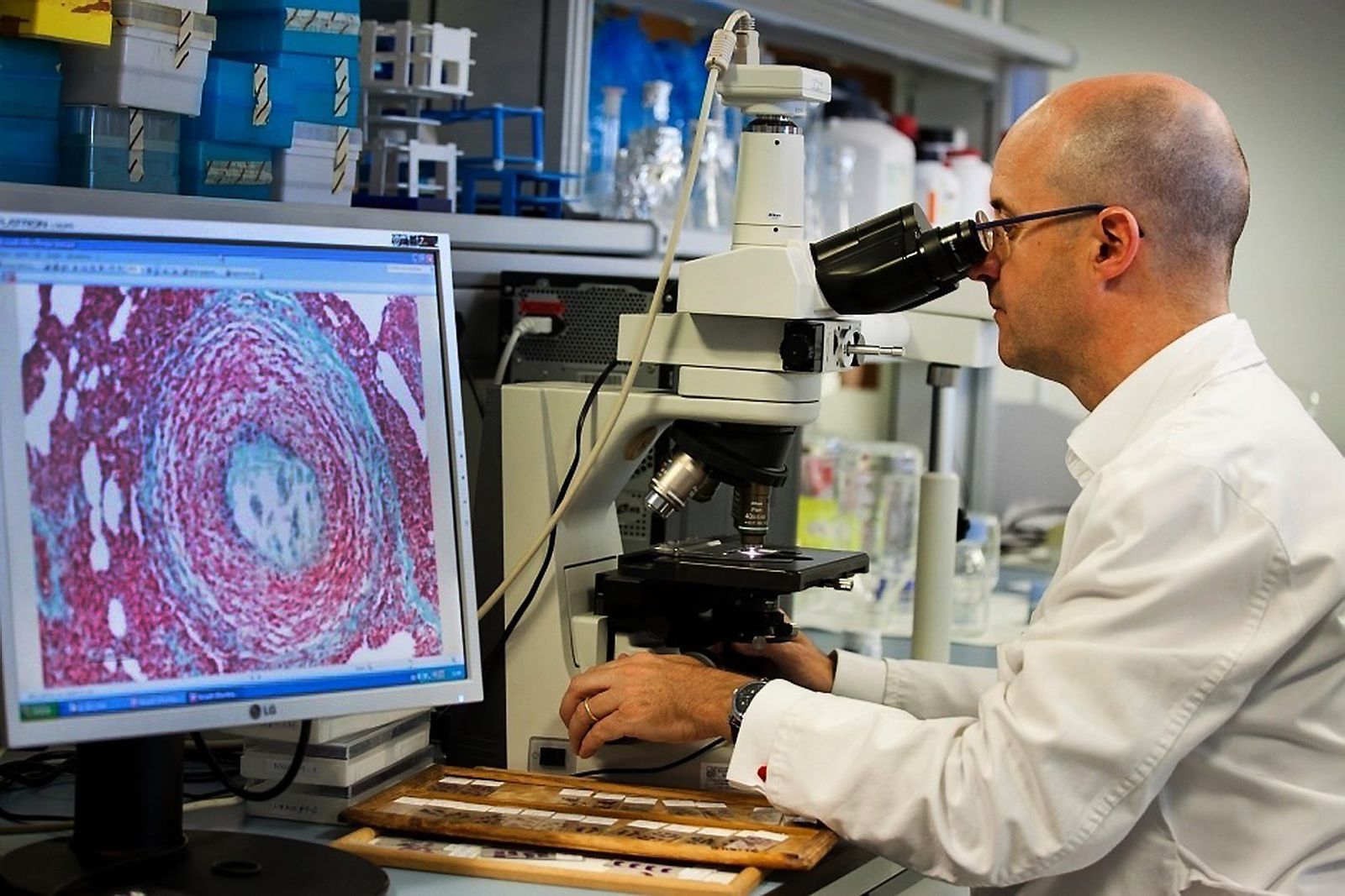 El investigador Pere Joan Cardona lidera desde Badalona varias líneas de investigación sobre el desarrollo de una vacuna.