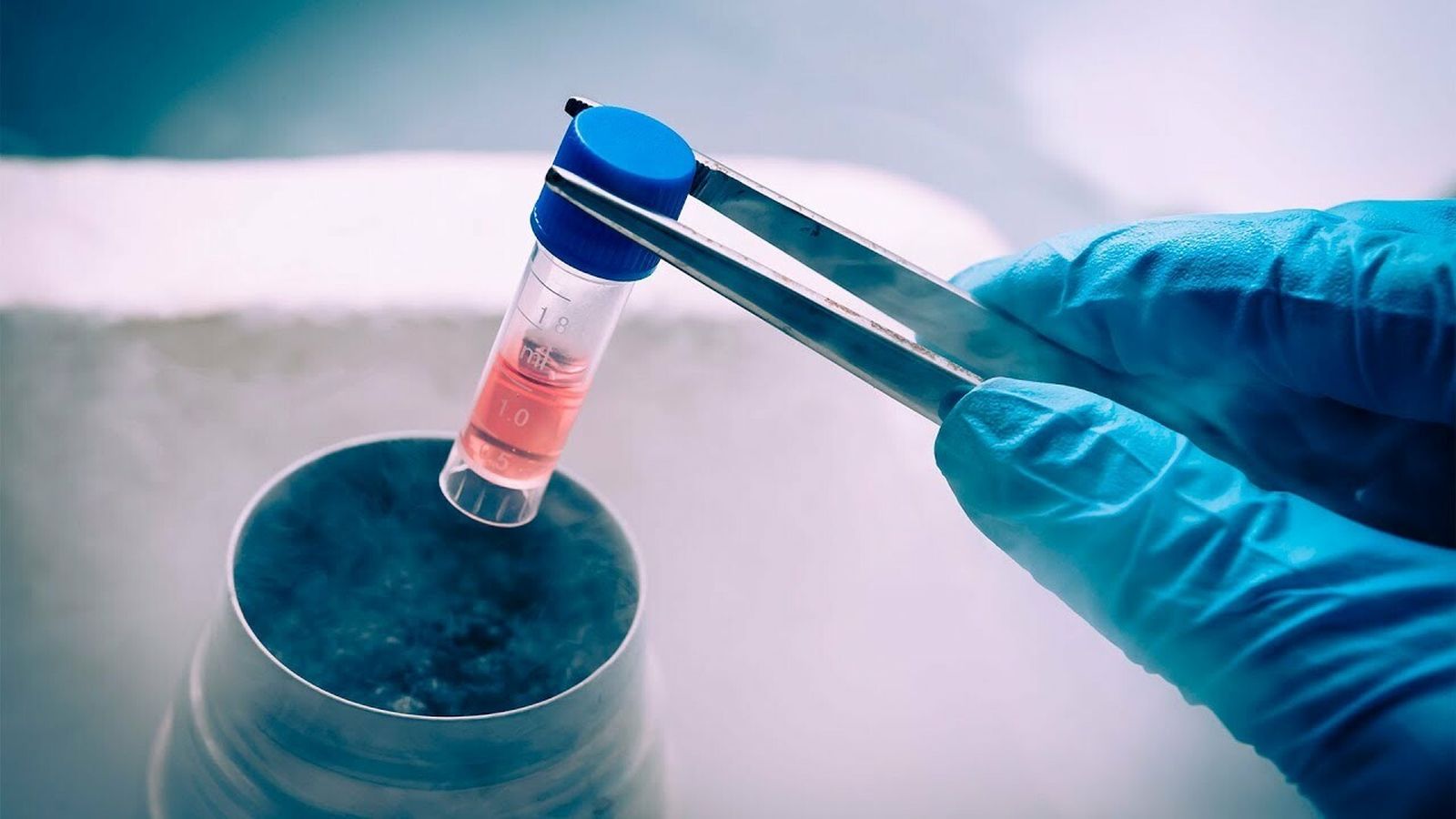 El primer caso con éxito de embrión congelado fue en 1983.