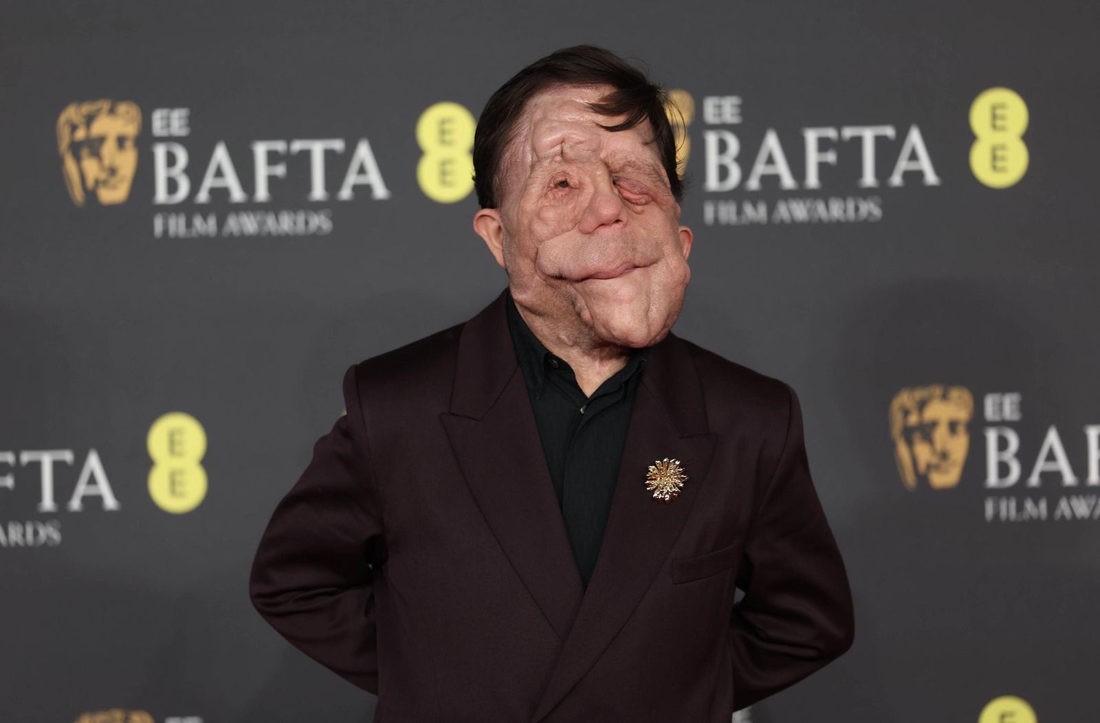 Las mejores imágenes de los BAFTA 2025