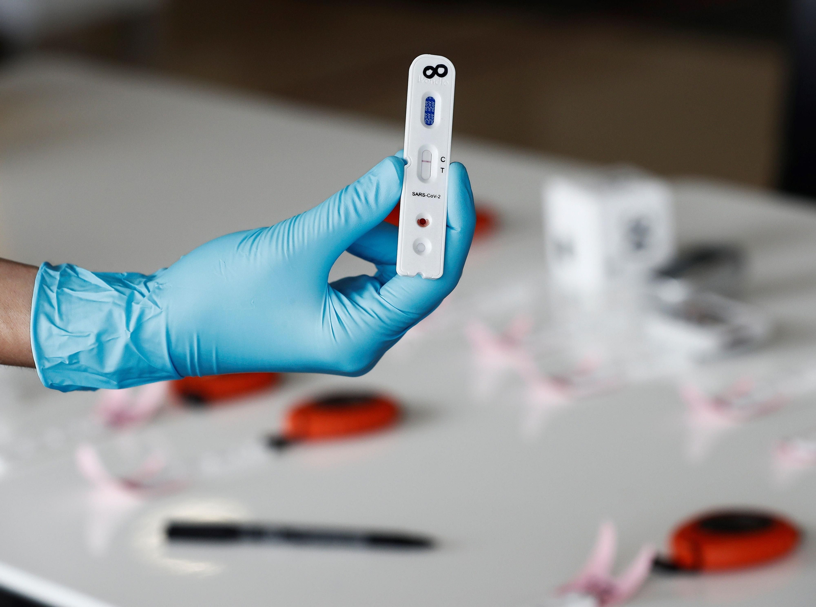 Los test rápidos ahora deben confirmarse con pruebas PCR.