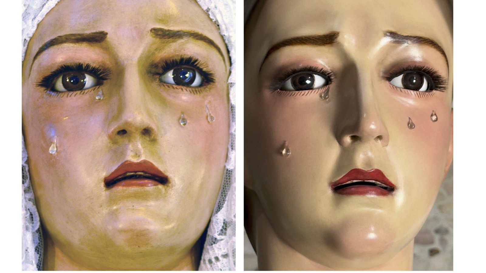 Antes y después de la reconstrucción de la dolorosa