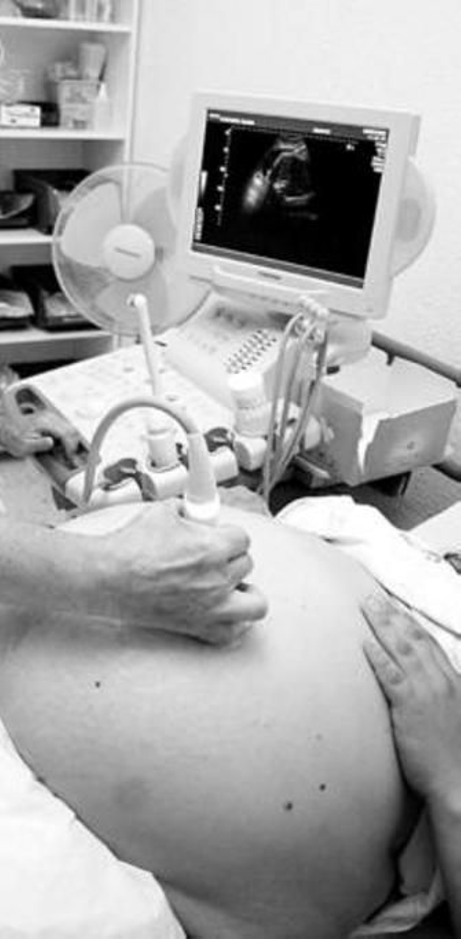 Un ginecólogo realiza una ecografía a una embarazada.