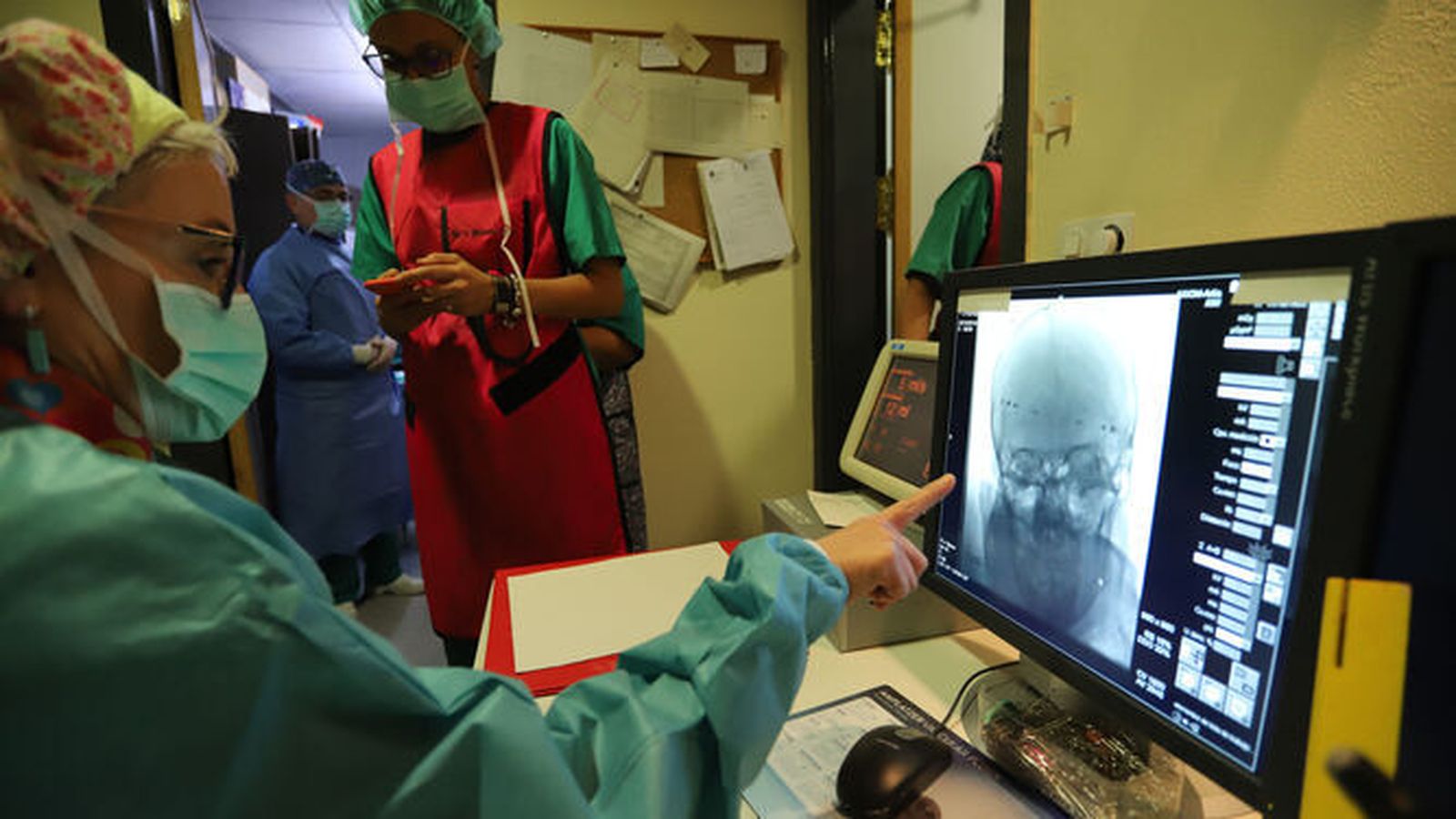 Médicos estudian un caso de ictus