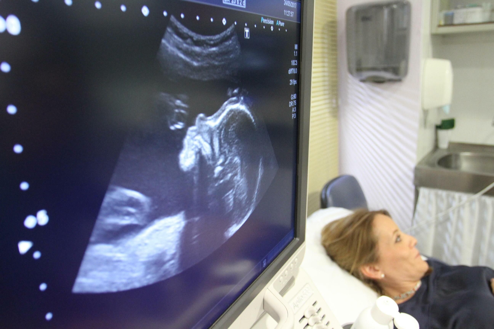 Exploración ecográfica de un feto.