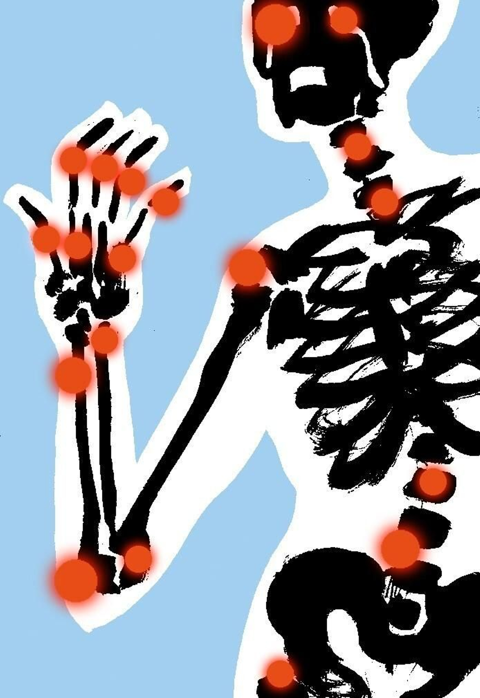 Artritis reumatoide: paciente y tratamiento