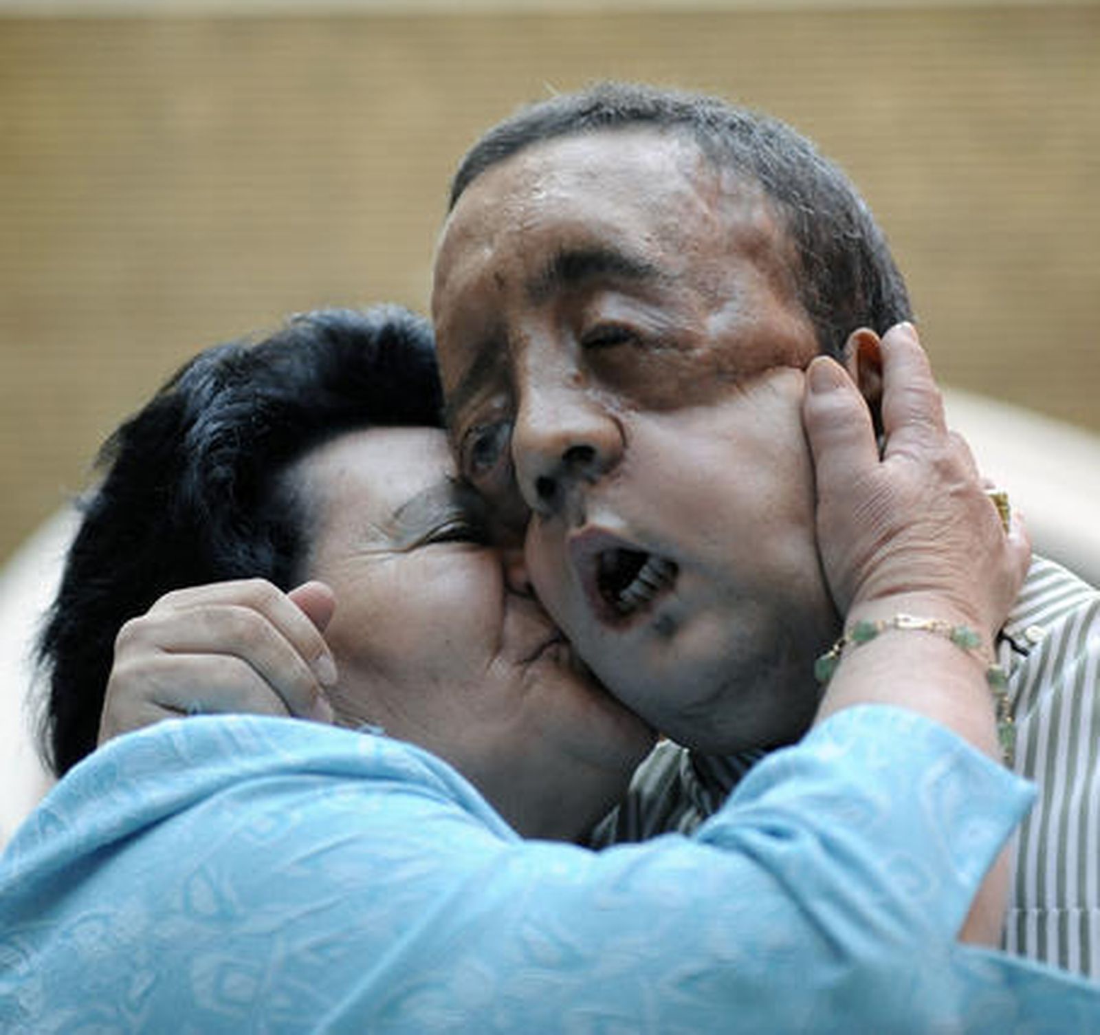 Rafael y su madre se abrazan tras la comparecencia del paciente al ser dado de alta.  Foto: Juan Carlos Vázquez