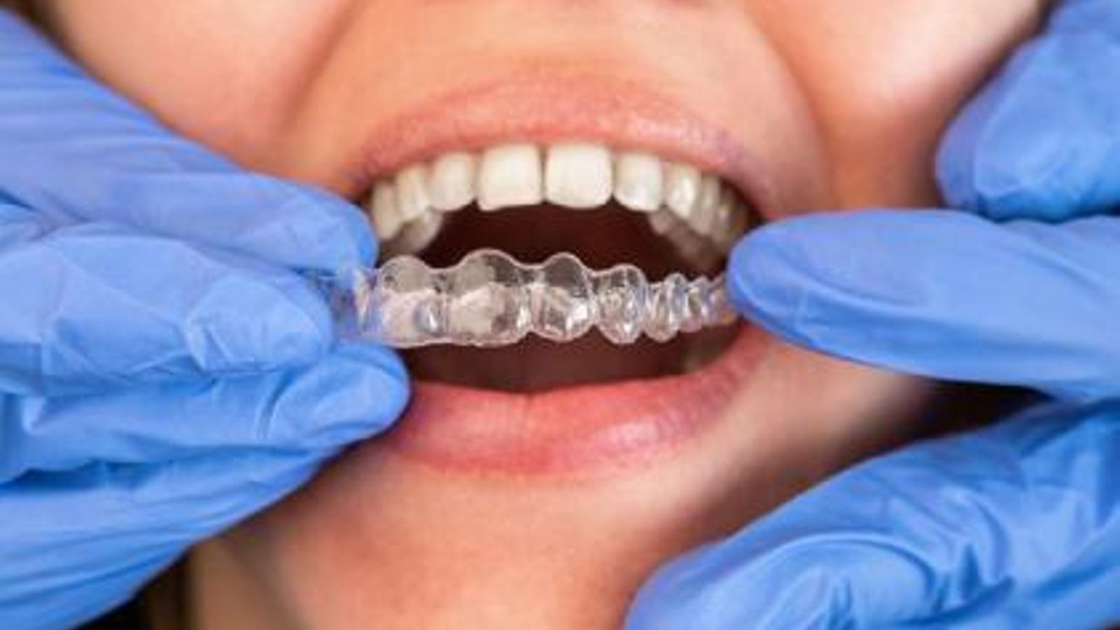 La planificación y supervisión profesional es muy importante para un buen resultado