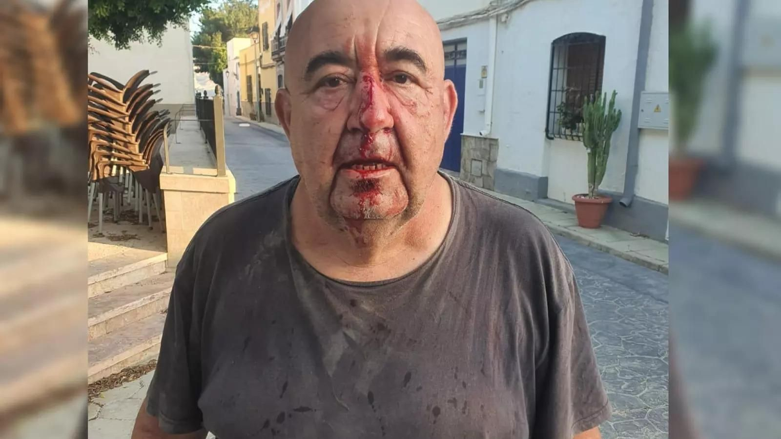 José Manuel Gil, concejal de Alsodux agredido el pasado mes de julio