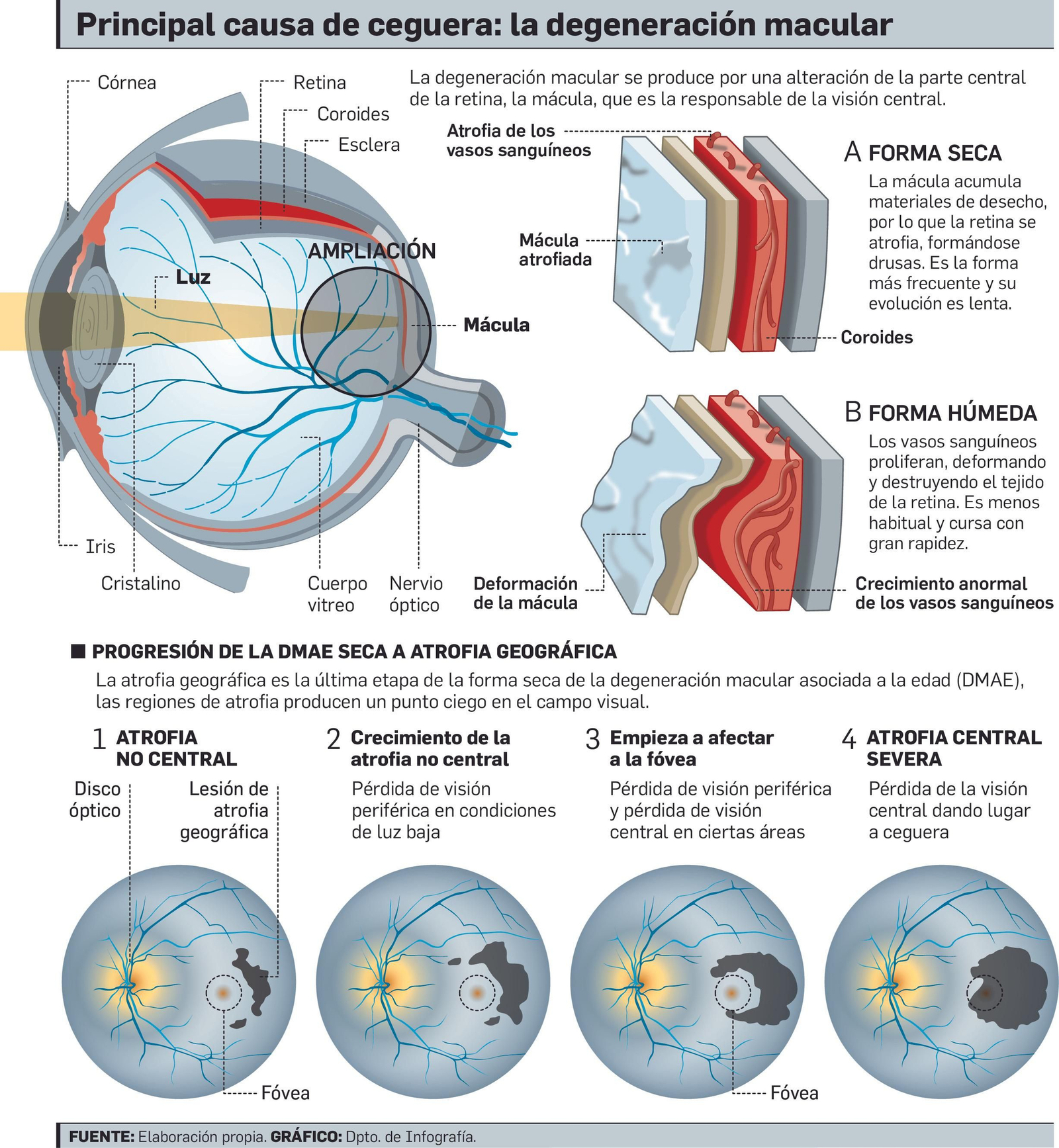 Así afecta la DMAE.