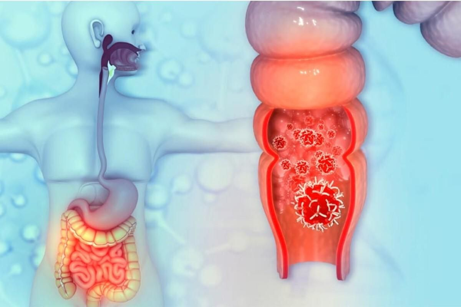 Aún quedan pendientes ciertas pruebas para evaluar la eficacia de este tratamiento