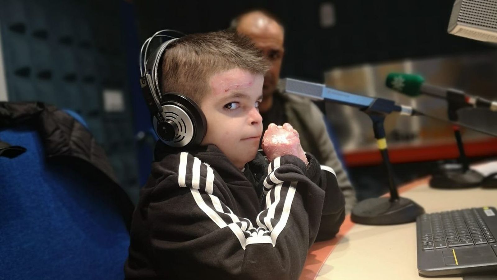 Leo quiere ser periodista para dar la noticia de que se ha encontrado la cura para la piel de mariposa.