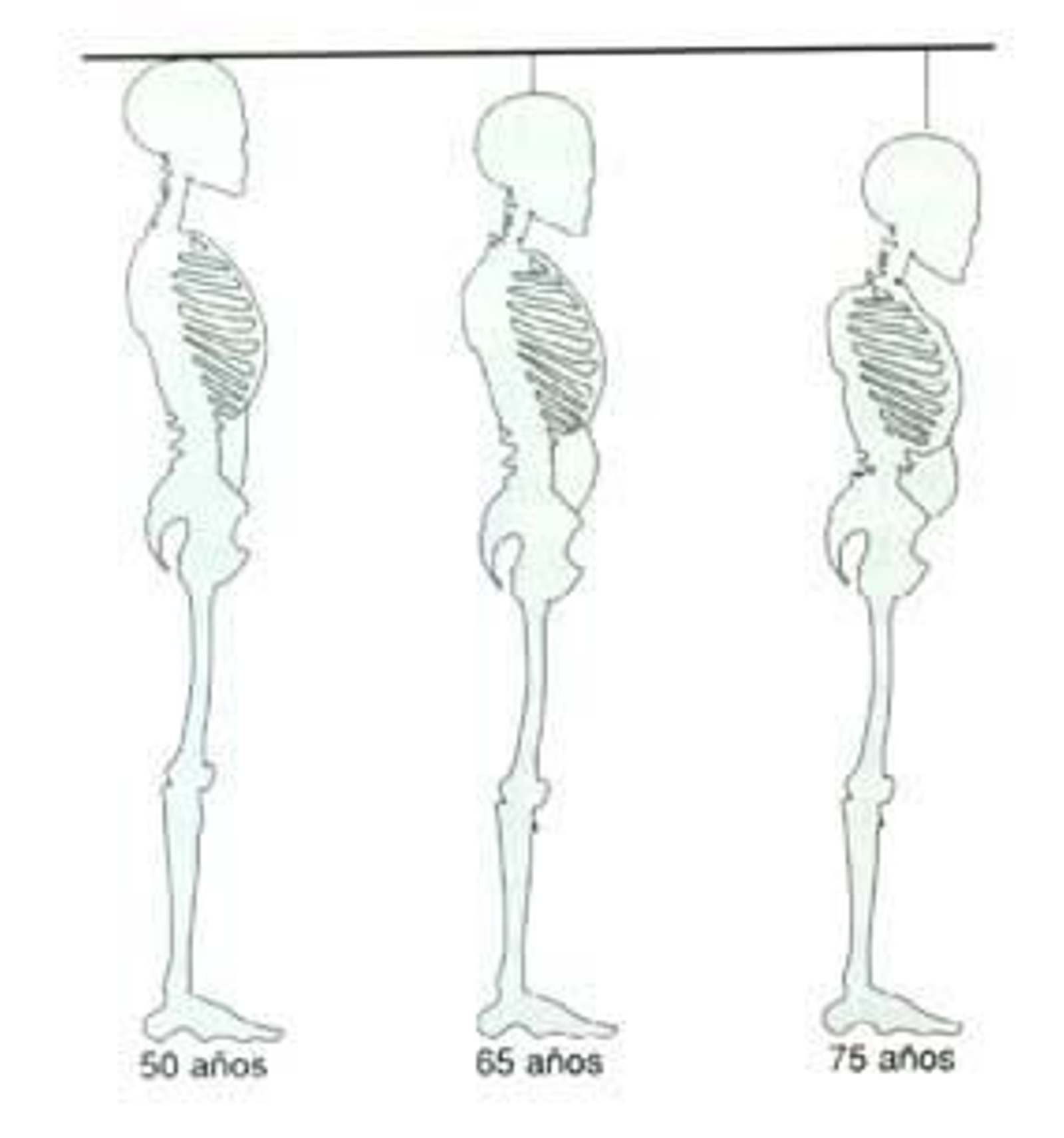 Evolución de la columna vertebral según la edad.