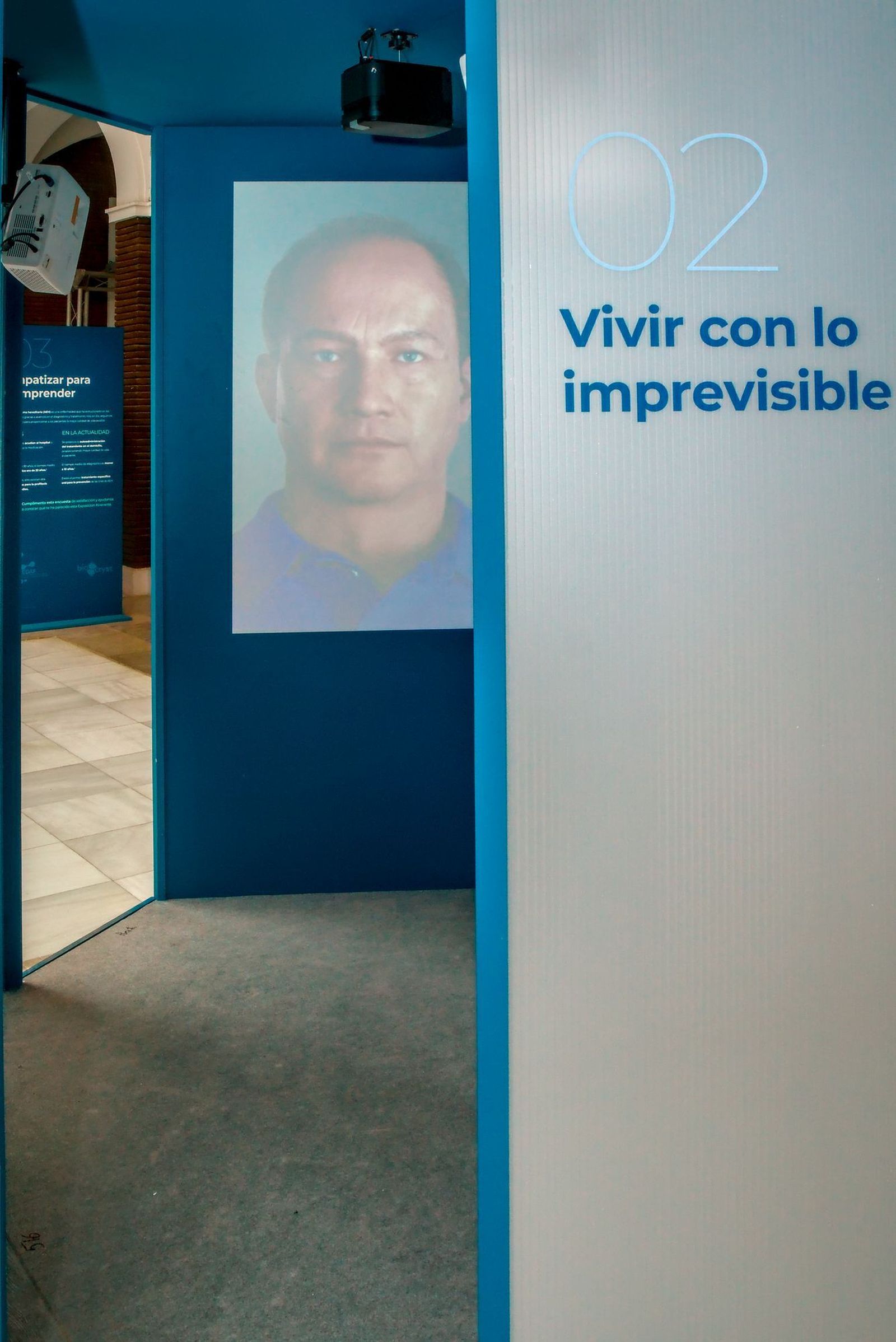 El Hospital Virgen del Rocío le 'pone cara' al angioedema hereditario