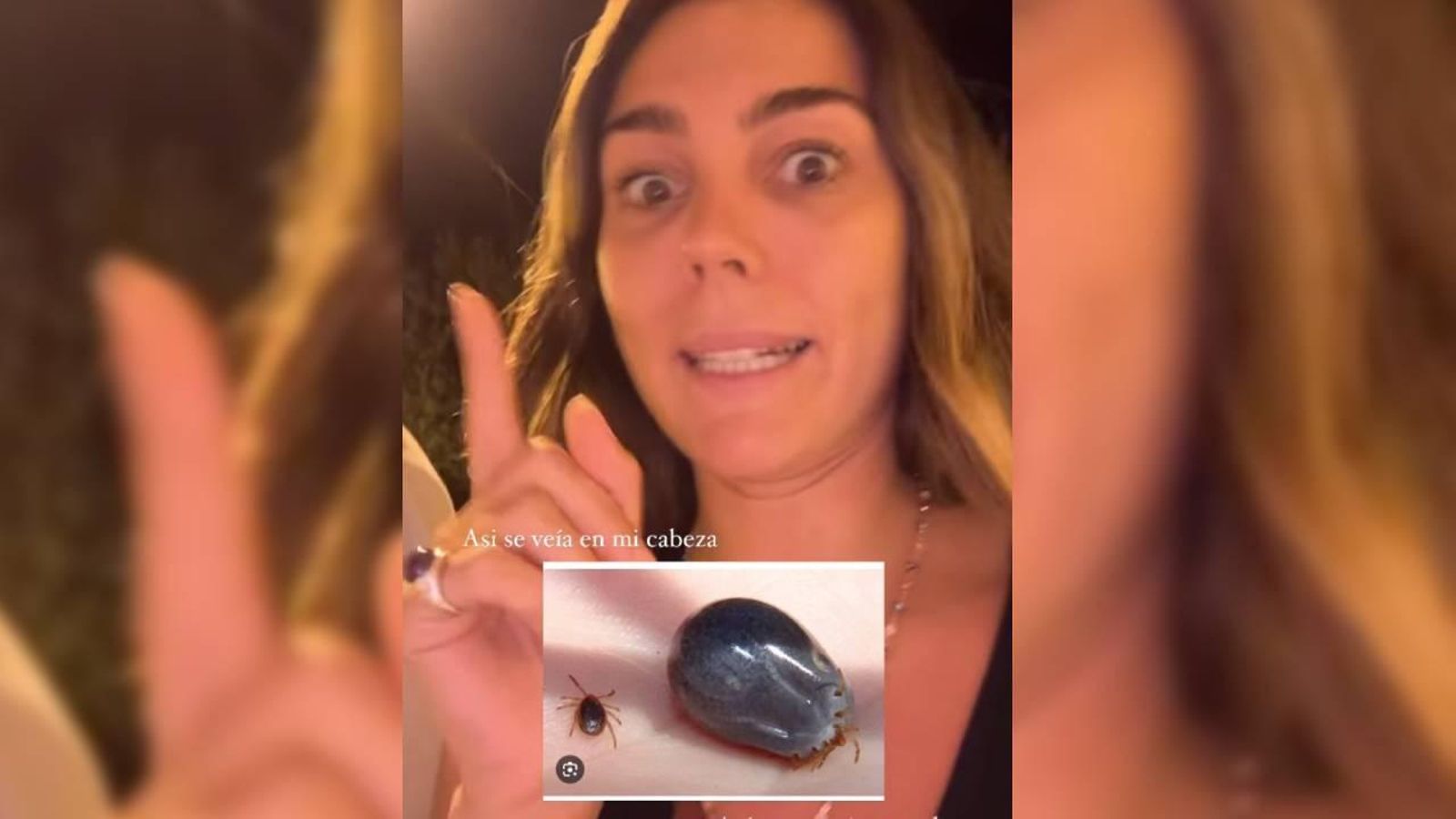 Anna Ferrer explica el episodio con la garrapata