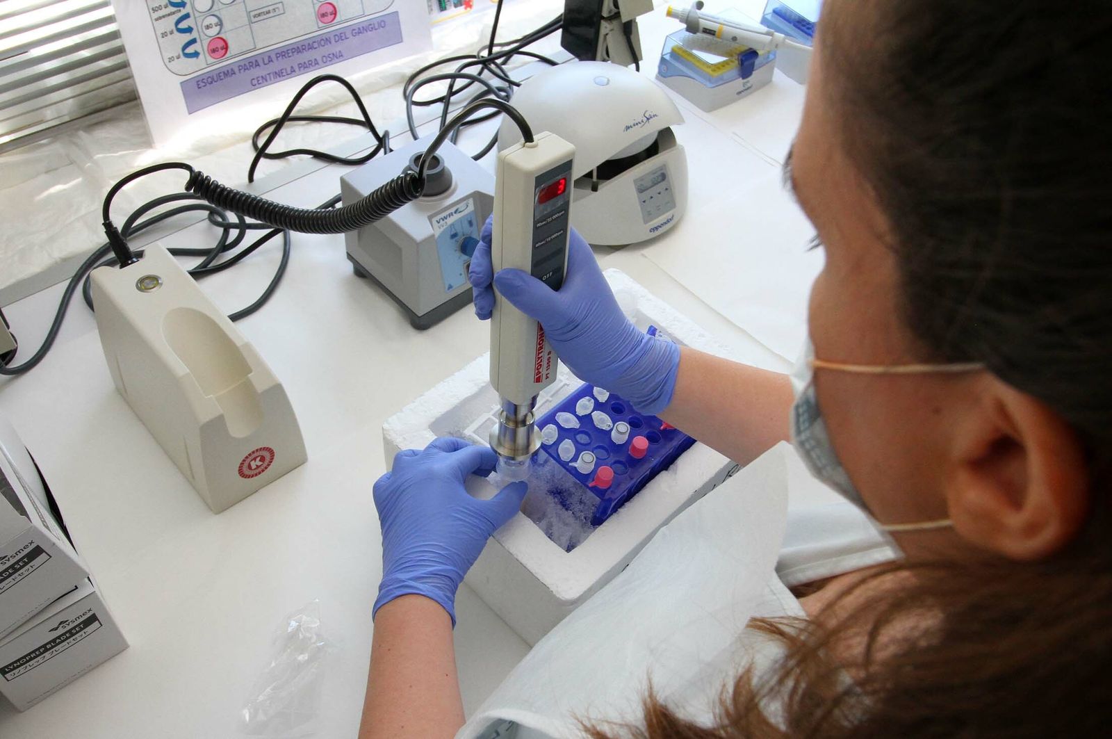 Una profesional realiza un análisis molecular de cáncer.