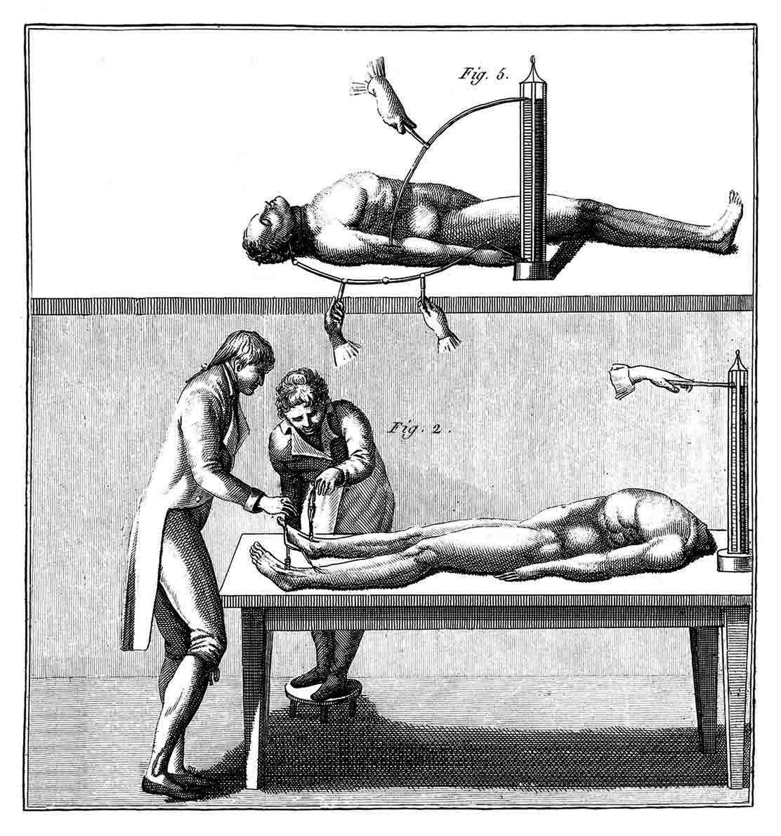 Ilustración de experiencias con bioelectrogénesis, siglo XIX.