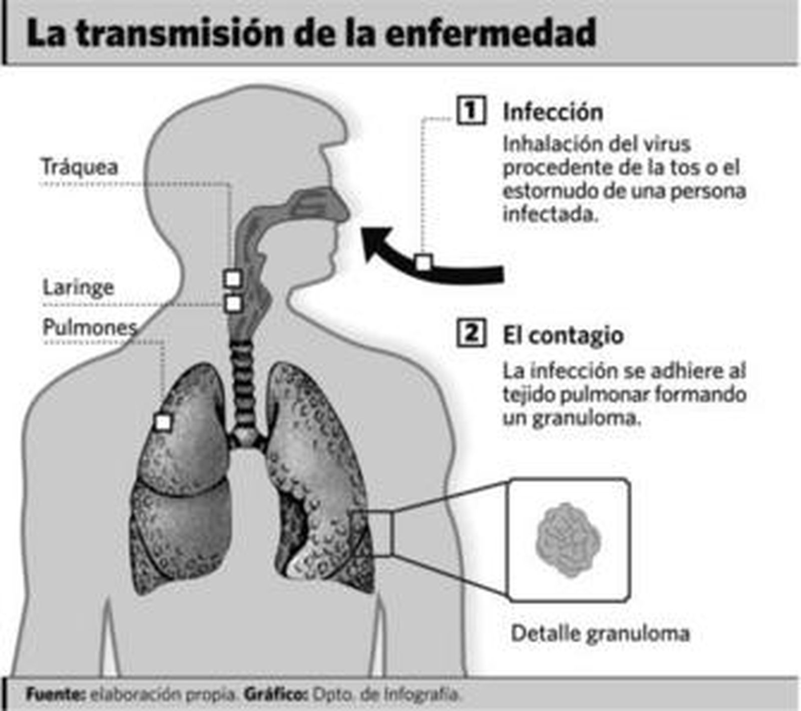 El Virgen del Rocío vigilará la tuberculosis en Andalucía occidental