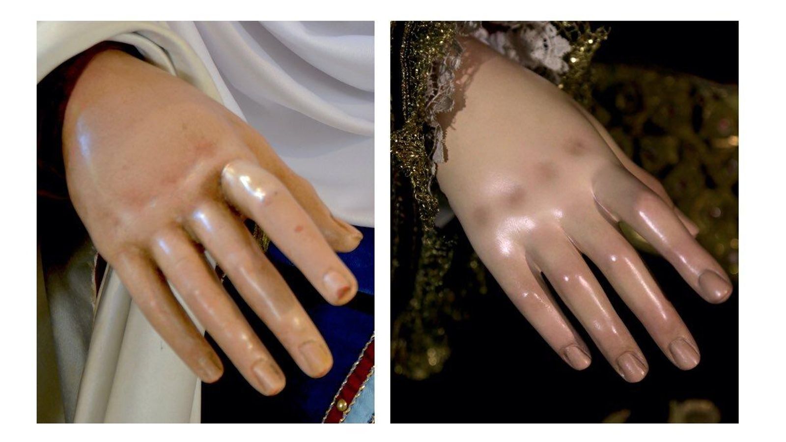 Las manos de la Esperanza