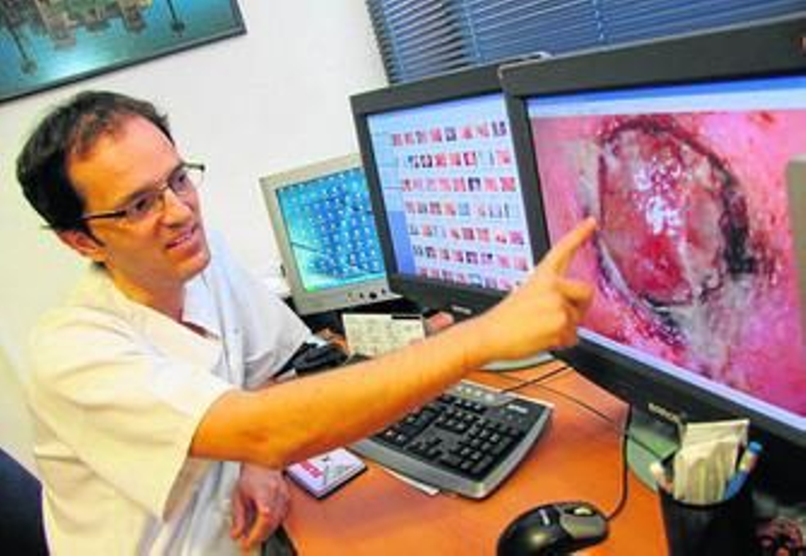 Silvestre Martínez, responsable de la Unidad de Melanoma, explica un caso.