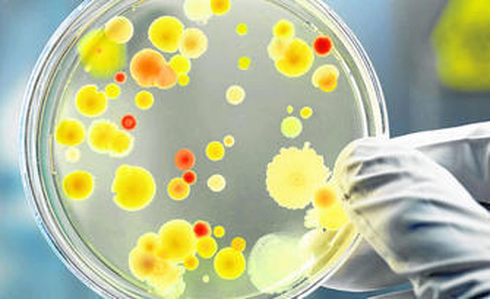 El problema se centra en los patógenos comunes causantes de infecciones graves como la neumonía, la diarrea o la septicemia.