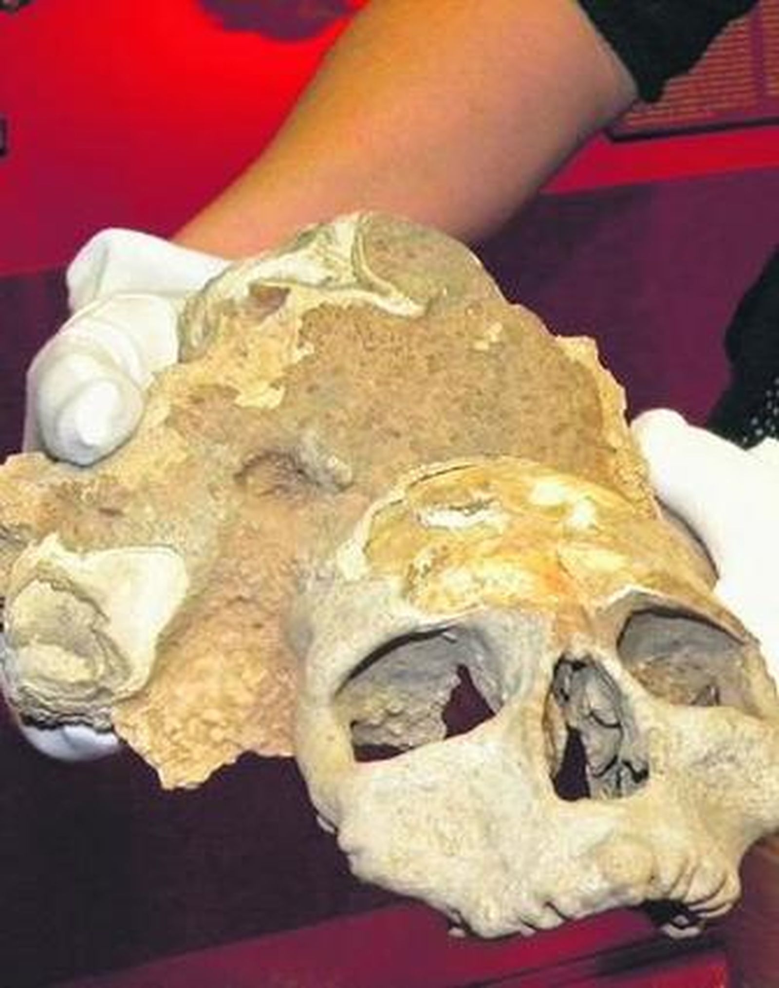 El cráneo 'Napoleón'.