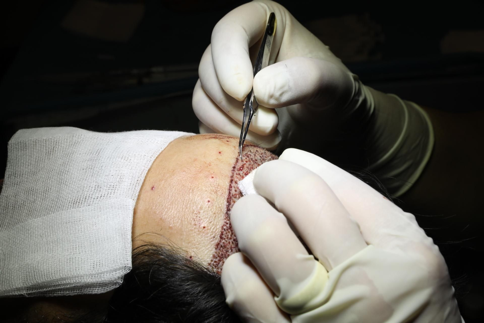 Fase de implantación en la clínica