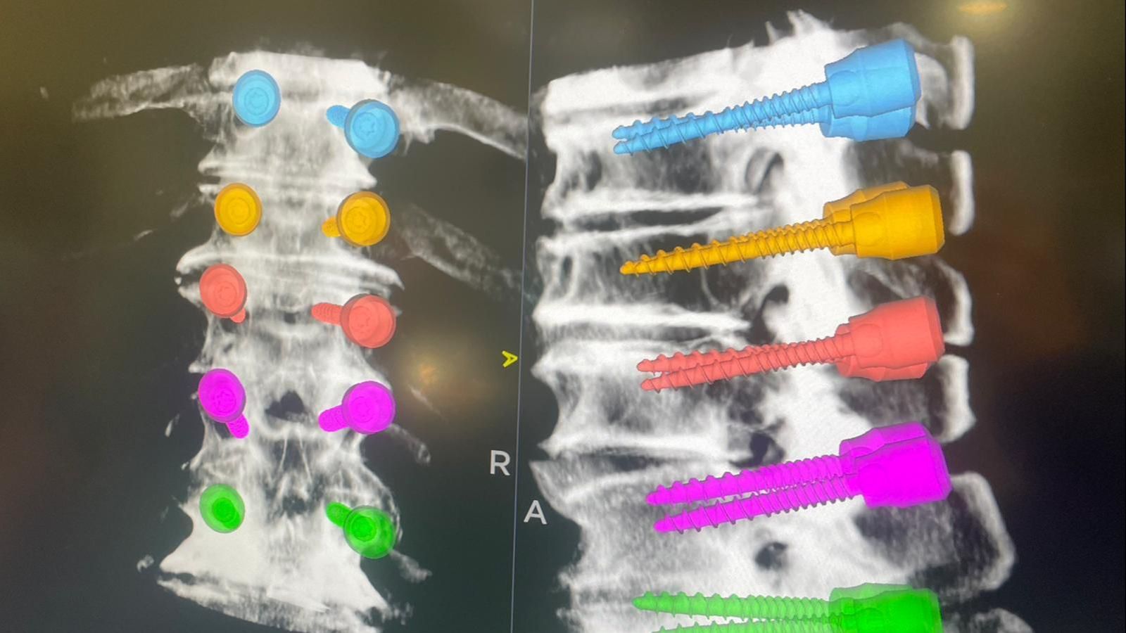 Navegador Qx al detalle mostrando los tornillos en la pantalla