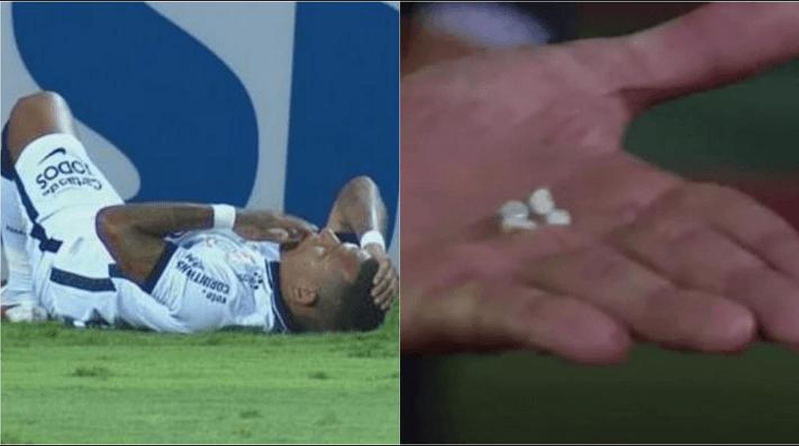 Rómulo Otero pierde 4 dientes.