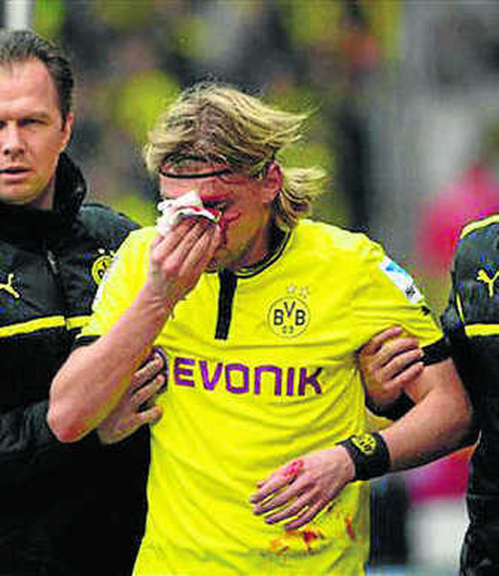 Schmelzer tras su lesión.