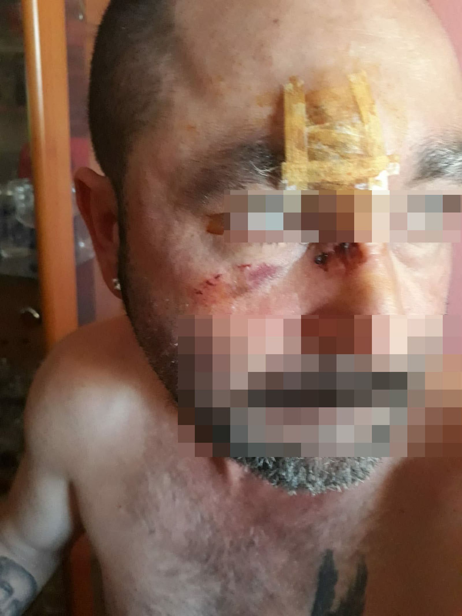 Detalle del rostro del herido en el que pueden apreciarse los daños.