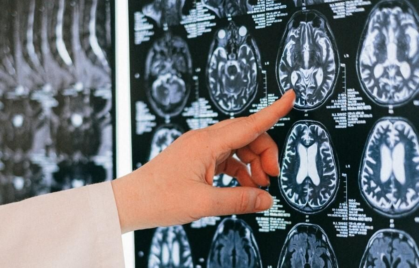 Imagen de la actividad cerebral de una persona. Imagen de la actividad cerebral de una persona.