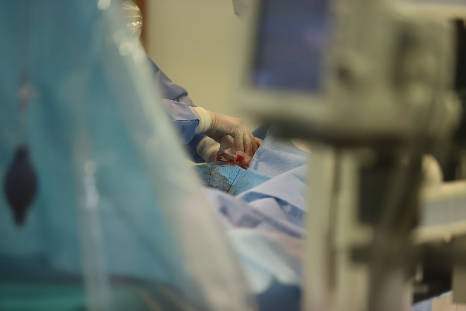 Operación de ictus en un hospital de Huelva.