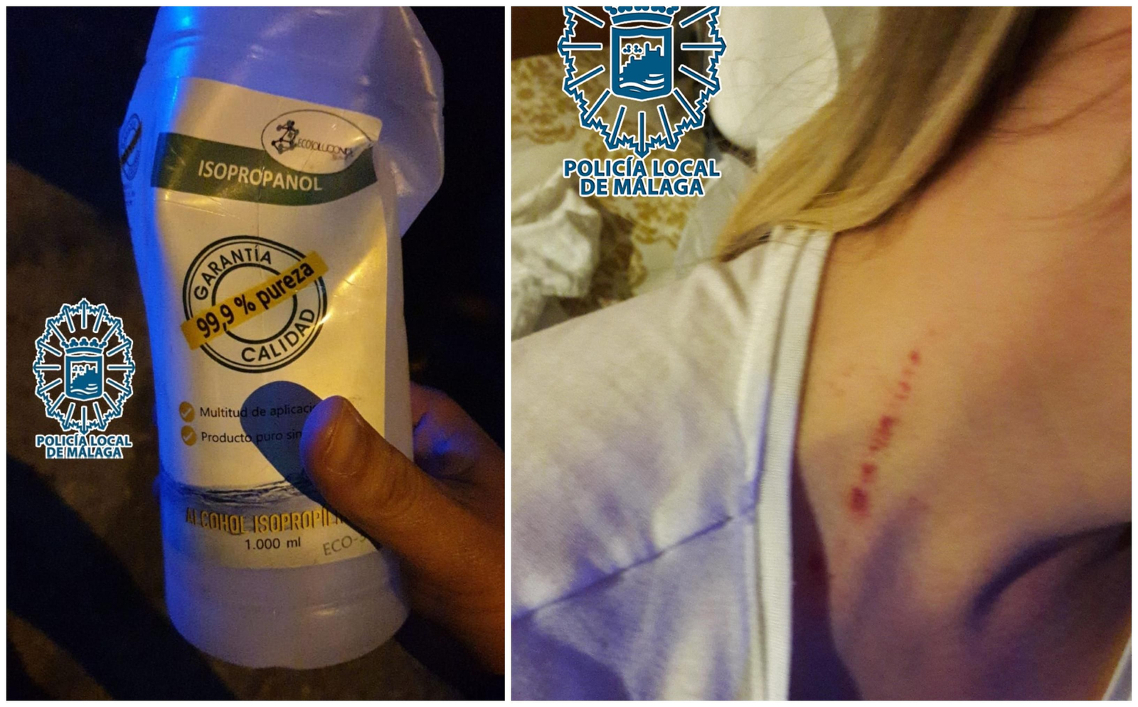 A la derecha, el producto líquido inflamable; y a la derecha, un arañazo sufrido por la víctima.