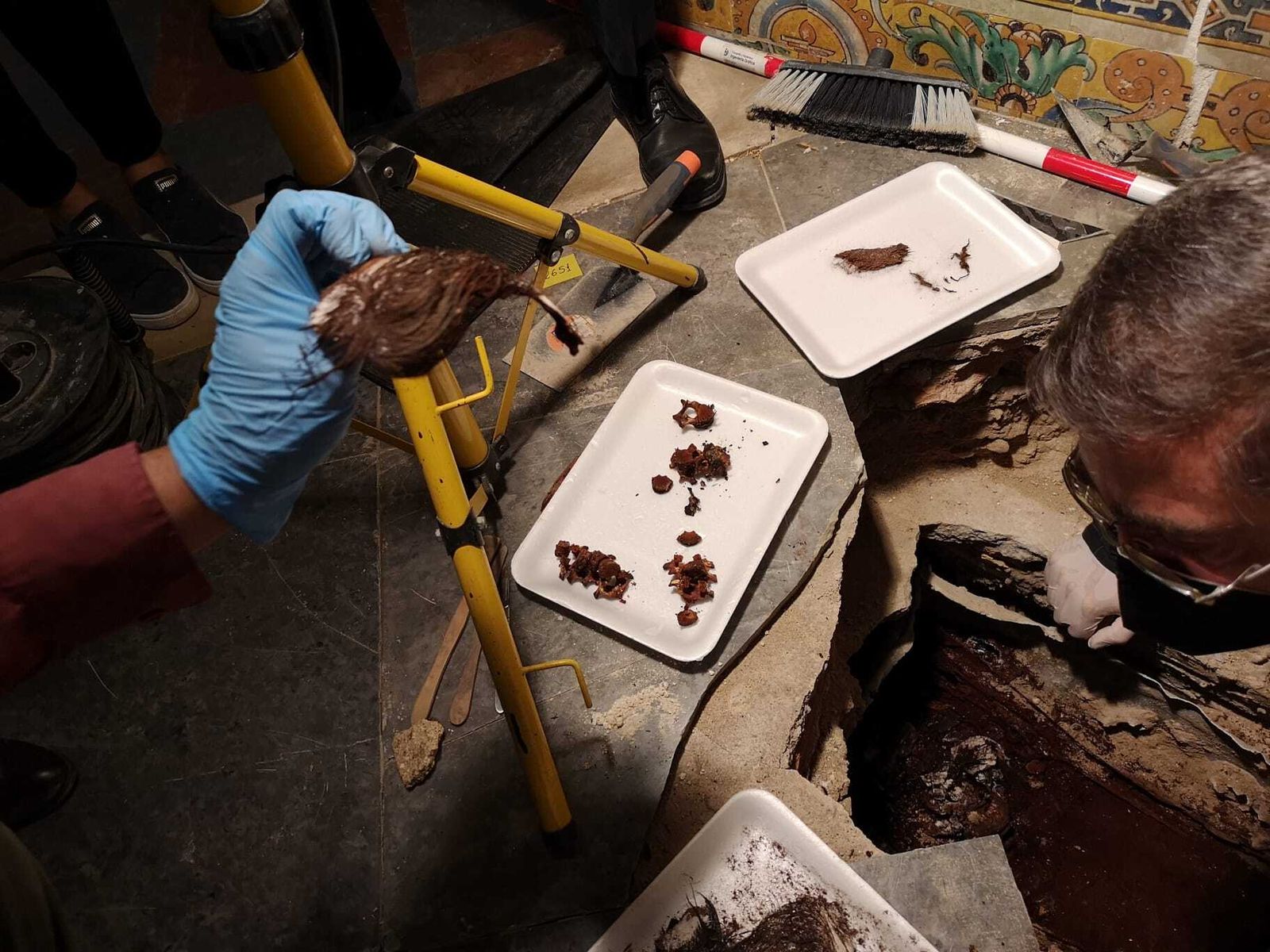 Un fragmento del cráneo de la niña en el que se puede ver el pelo.