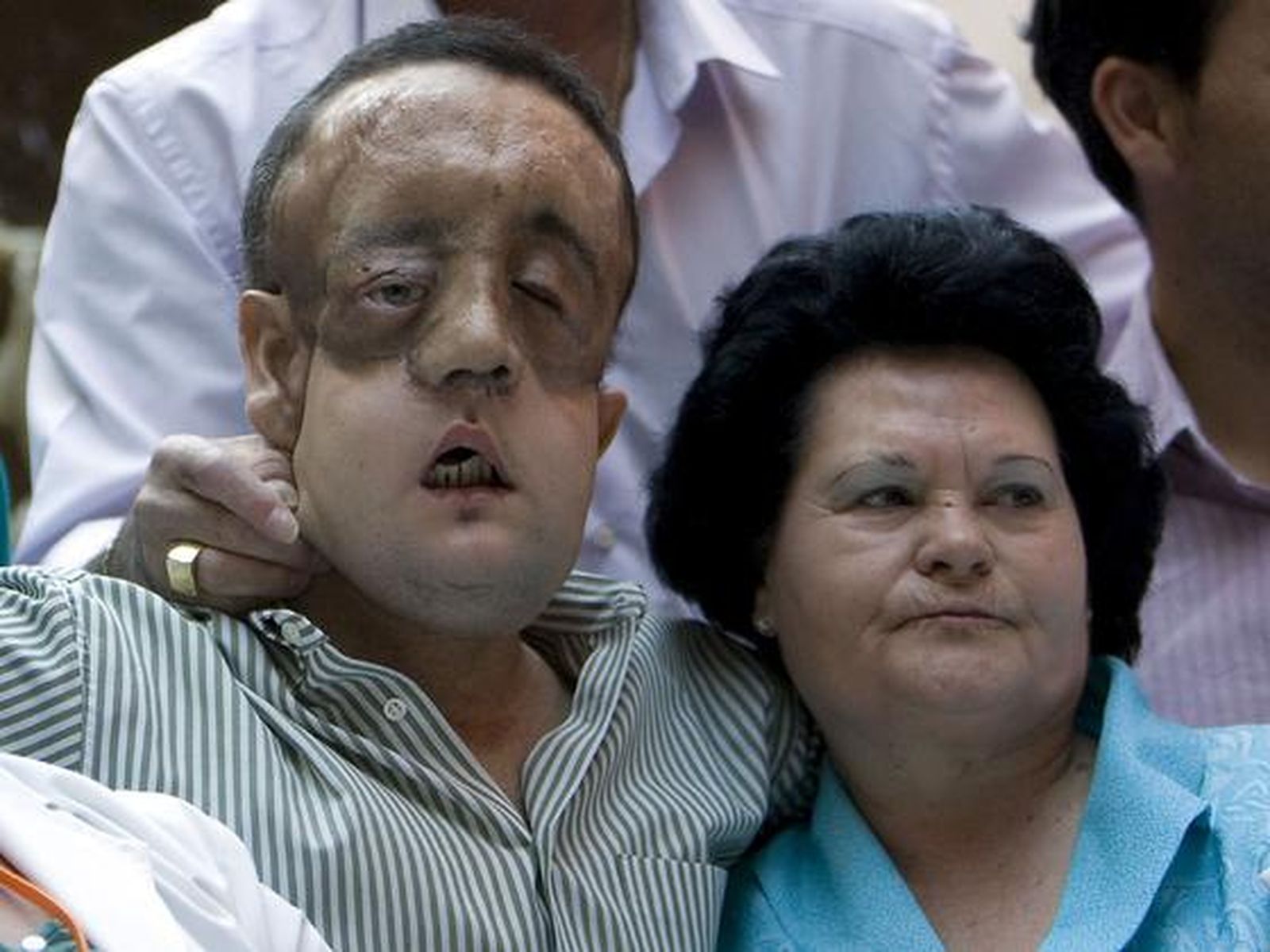 Rafael y su madre se abrazan tras la comparecencia del paciente tras ser dado de alta.

Foto: Juan Carlos Vázquez