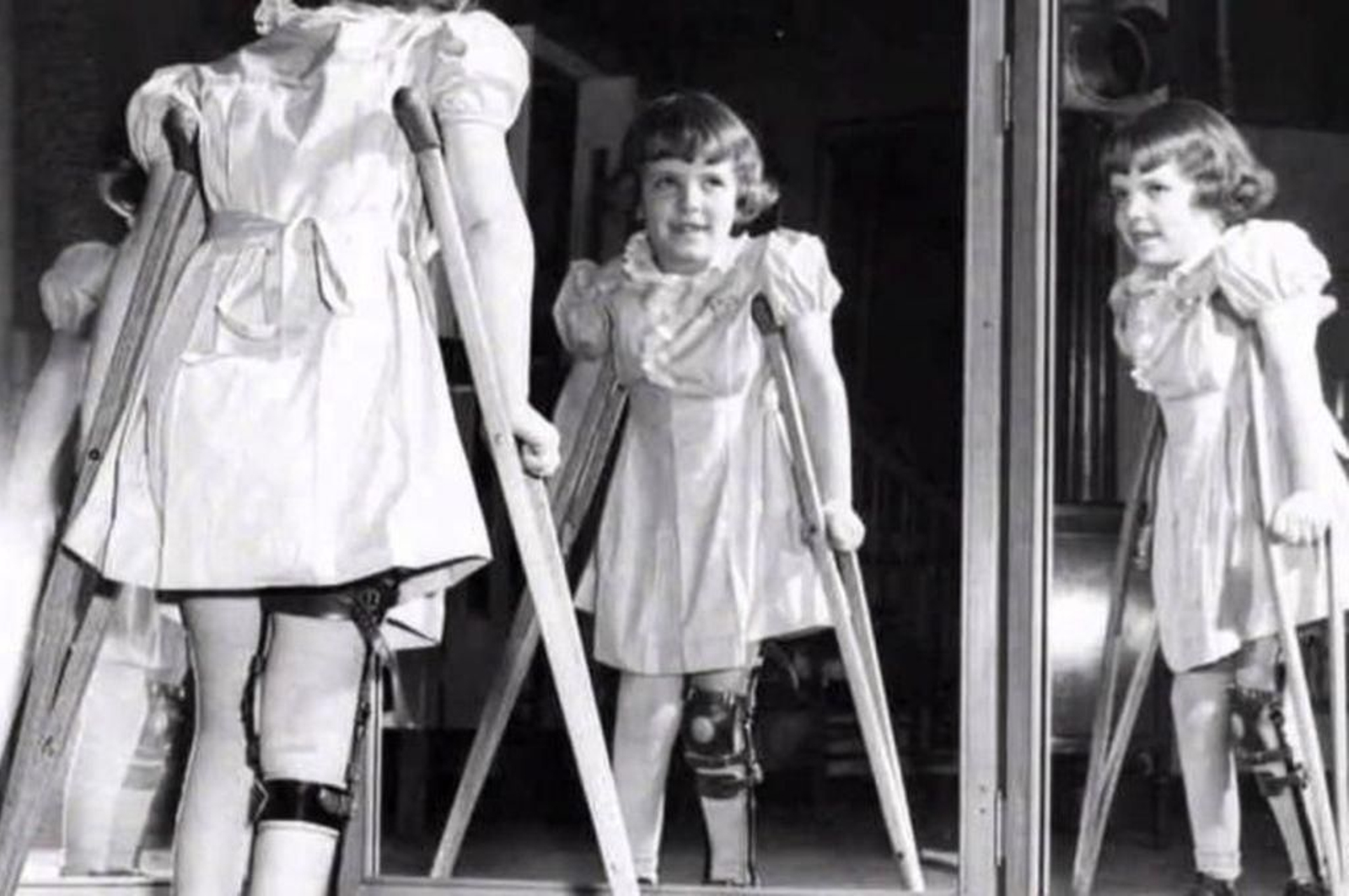 Niñas afectadas con la enfermedad.