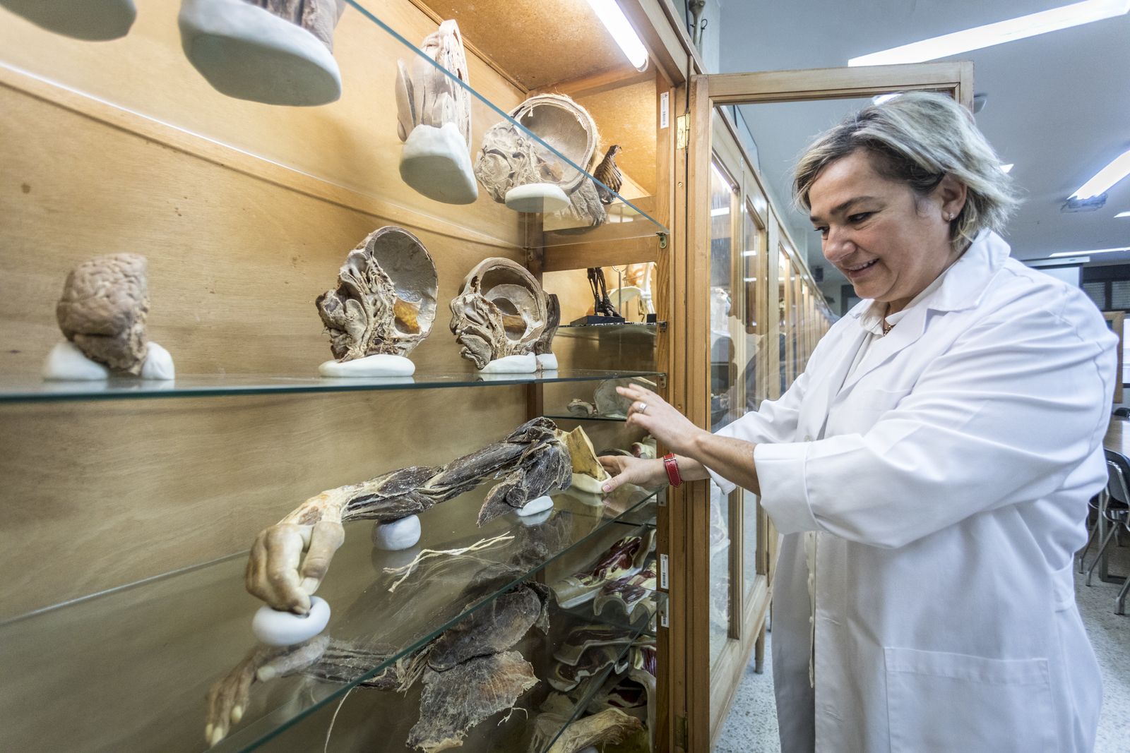 Cristina Verástegui muestra un brazo que se exhibe en el Museo Anatómico de su Departamento.