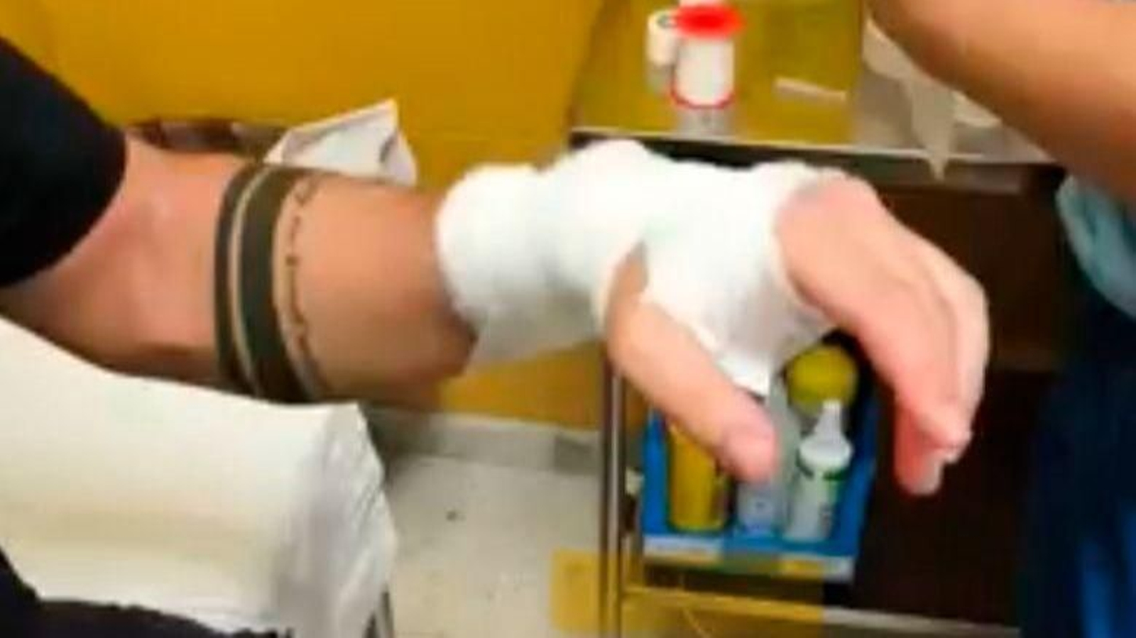 El policía que recibió el mordisco necesitó de un vendaje para que la herida no se infecte.