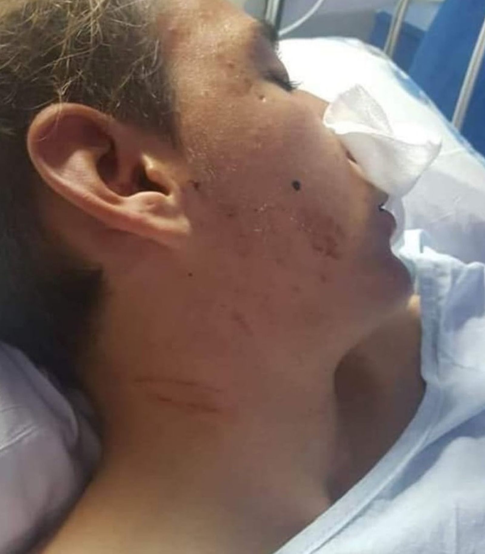 Estado del menor tras la paliza de unos policías en Melilla