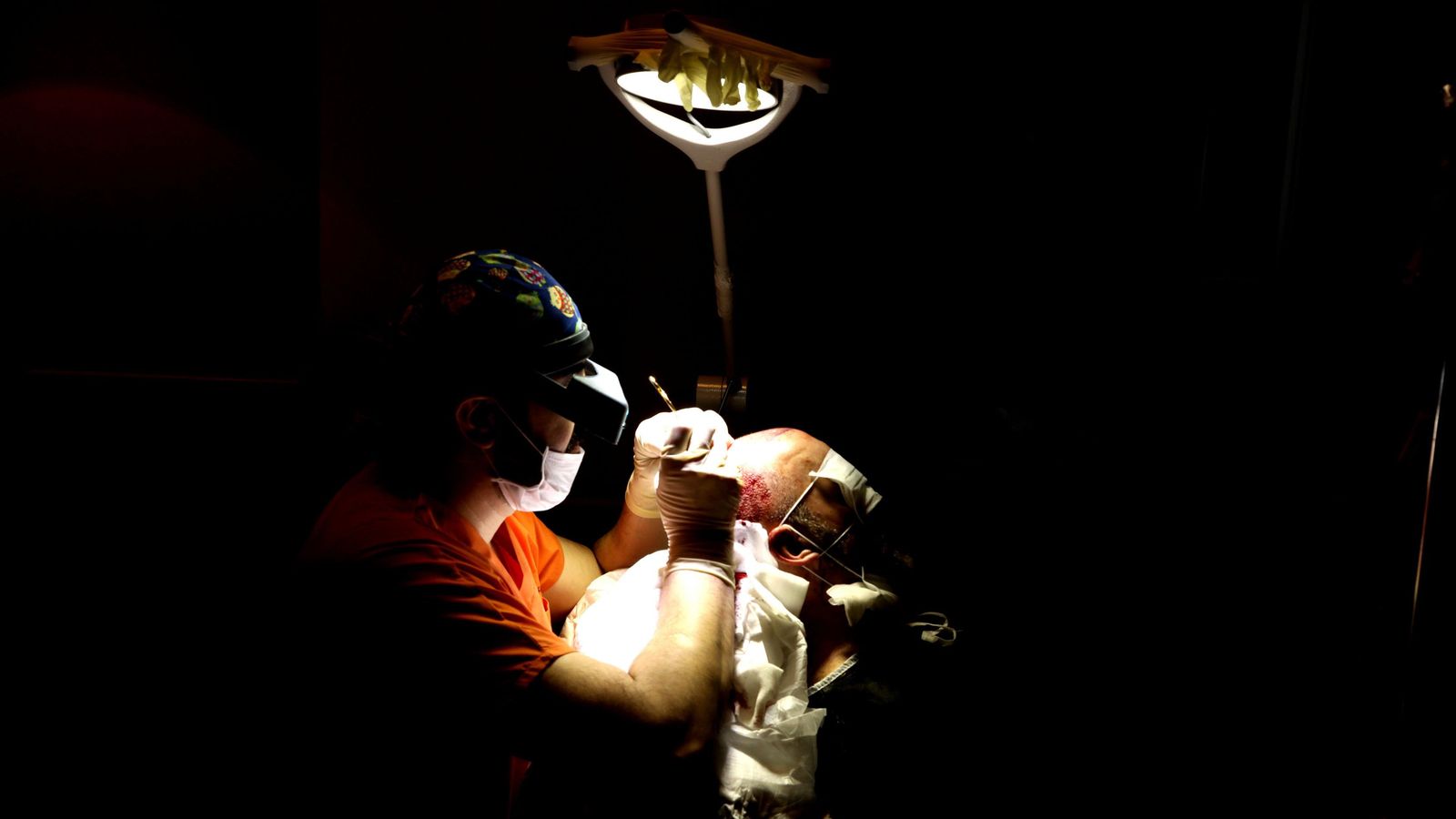 apertura de canales por el  doctor Emrah Cinik