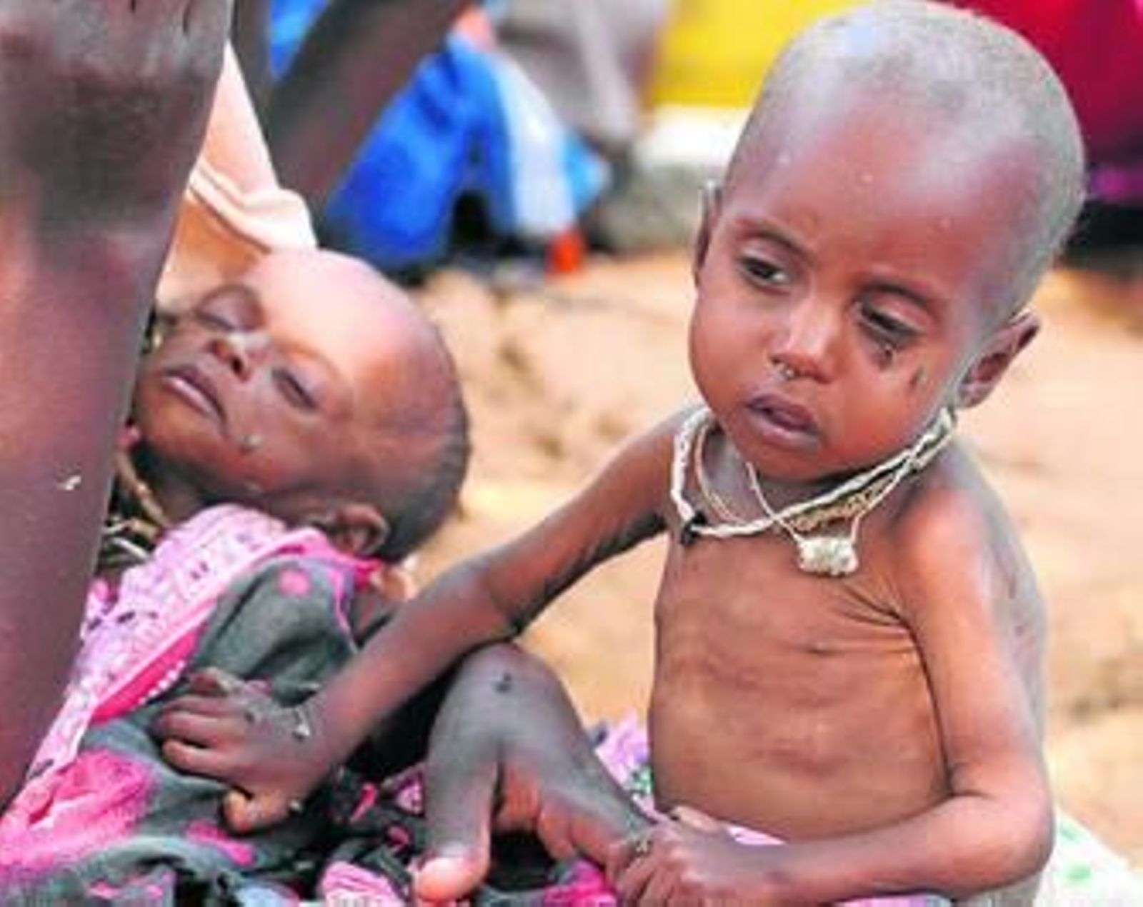 Unos niños desnutridos en un campo de refugiados de Mogadiscio.