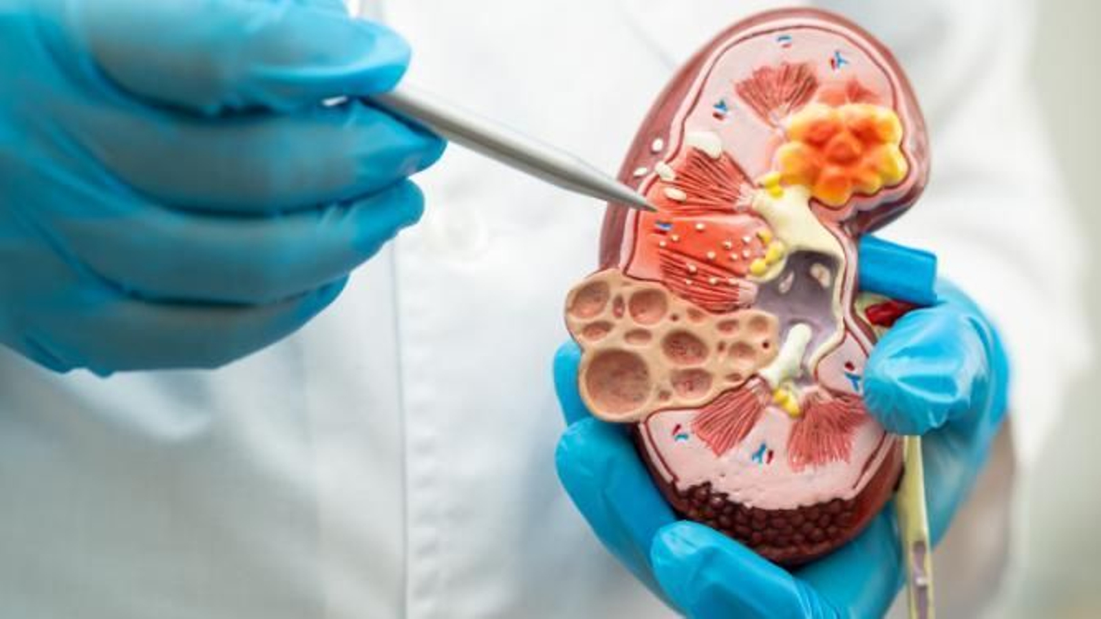 Interior de un riñón.