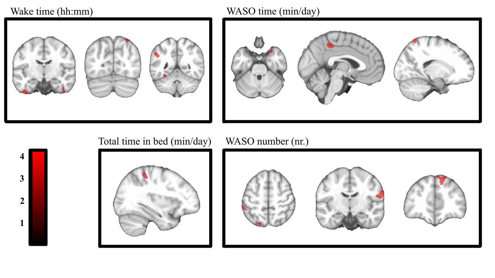 Imágenes del estudio sobre el sueño de los niños en la UGR