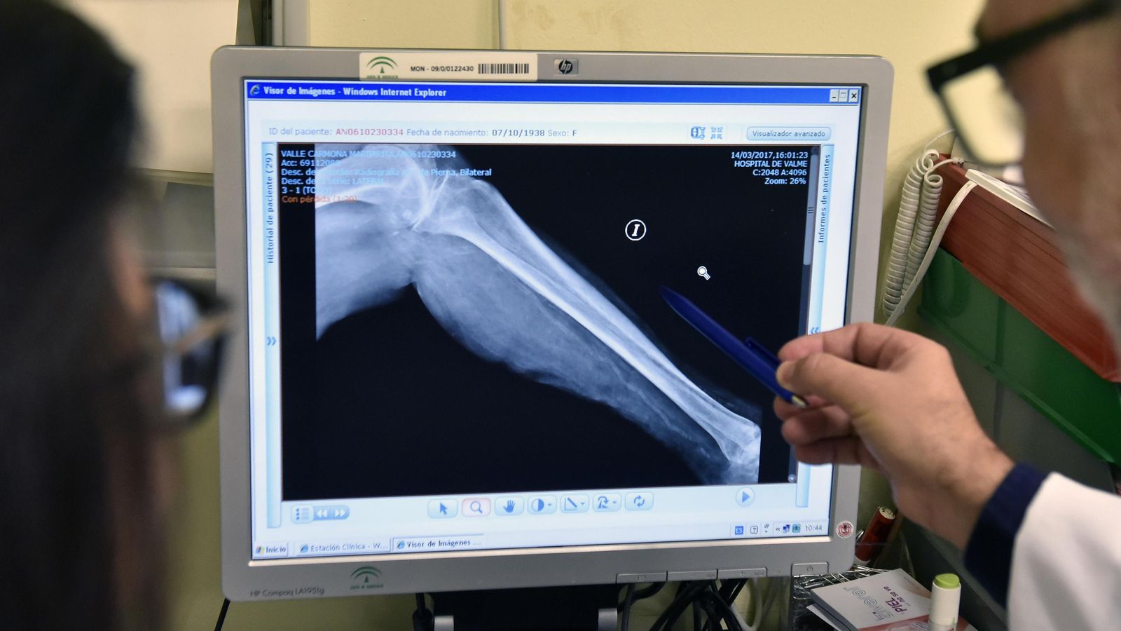 La radiografía muestra la acumulación de calcio en los vasos.