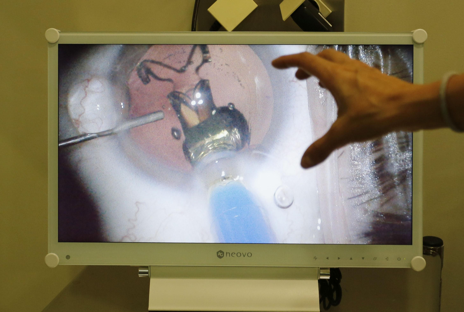 Imagen de archivo de una operación de la vista.