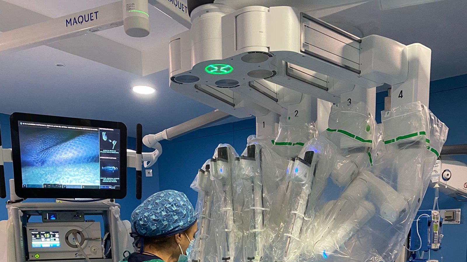 Operación de cirugía bariátrica robótica en el hospital Universitario Puerta del Mar de Cádiz